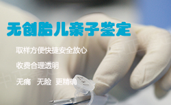 在上饶怀孕了需要怎么办理怀孕亲子鉴定，上饶办理孕期亲子鉴定准确性高吗